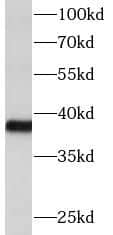 Western Blot DTX3 Antibody - BSA Free