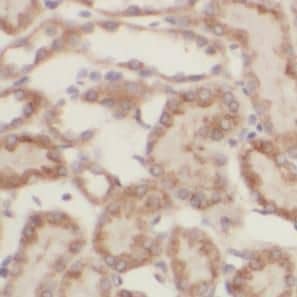 Immunohistochemistry DTX3 Antibody - BSA Free