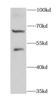 Western Blot: DTX2 Antibody - BSA Free [NBP3-46626] - Mouse lung tissue were subjected to SDS PAGE followed by western blot with (DTX2 antibody) at dilution of 1:1000