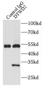 Immunoprecipitation: DTW Domain Containing 2 Antibody - BSA Free [NBP3-46628] - IP Result of anti-DTWD2 (IP:, 3ug; Detection: 1:300) with COLO 320 cells lysate 2000ug.