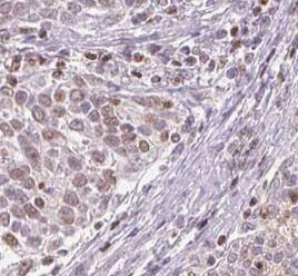 Immunohistochemistry DSS1 Antibody - BSA Free