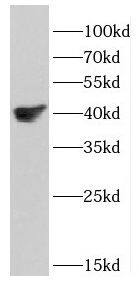 Western Blot DSN1 Antibody - BSA Free
