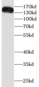 Western Blot Drosha Antibody - BSA Free