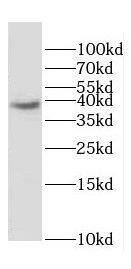 Western Blot DOK6 Antibody - BSA Free