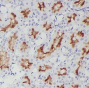 Immunohistochemistry: DOCK9 Antibody - BSA Free [NBP3-46639] - Immunohistochemistry of paraffin-embedded human kidney tissue slide using (DOCK9 Antibody) at dilution of 1:200