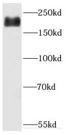 Western Blot: DOCK9 Antibody - BSA Free [NBP3-46639] - A549 cells were subjected to SDS PAGE followed by western blot with (DOCK9 antibody) at dilution of 1:500