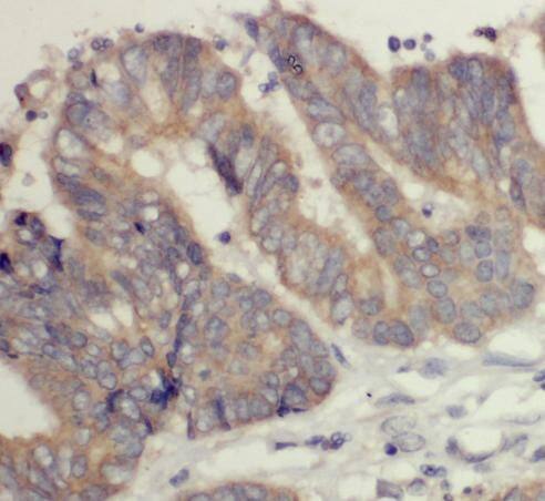 Immunohistochemistry DOCK6 Antibody - BSA Free