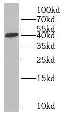 Western Blot: RTCD1 Antibody - BSA Free [NBP3-46644] - K-562 cells were subjected to SDS PAGE followed by western blot with (RTCD1 antibody) at dilution of 1:500