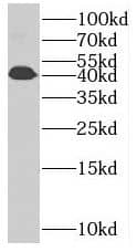 Western Blot: RRS1 Antibody - BSA Free [NBP3-46647] - K-562 cells were subjected to SDS PAGE followed by western blot with (RRS1 antibody) at dilution of 1:500