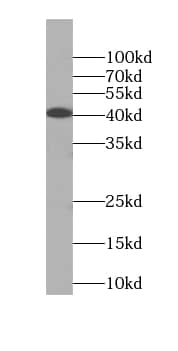 Western Blot: RRP36 Antibody - BSA Free [NBP3-46649] - MCF-7 cells were subjected to SDS PAGE followed by western blot with ( RRP36