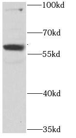 Western Blot: RPS6KL1 Antibody - BSA Free [NBP3-46654] - CHO cells were subjected to SDS PAGE followed by western blot with ( RPS6KL1 Antibody) at dilution of 1:1000