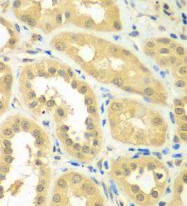 Immunohistochemistry: RPS6KL1 Antibody - BSA Free [NBP3-46654] - Immunohistochemistry of paraffin-embedded human kidney using ( RPS6KL1 Antibody) at dilution of 1:50