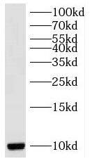 Western Blot: RPS27L Antibody - BSA Free [NBP3-46658] - SH-SY5Y cells were subjected to SDS PAGE followed by western blot with (RPS27L antibody) at dilution of 1:300
