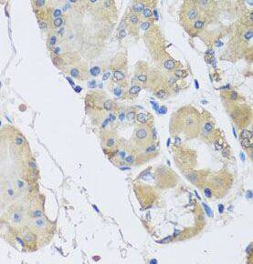 Immunohistochemistry RPLP1 Antibody - BSA Free