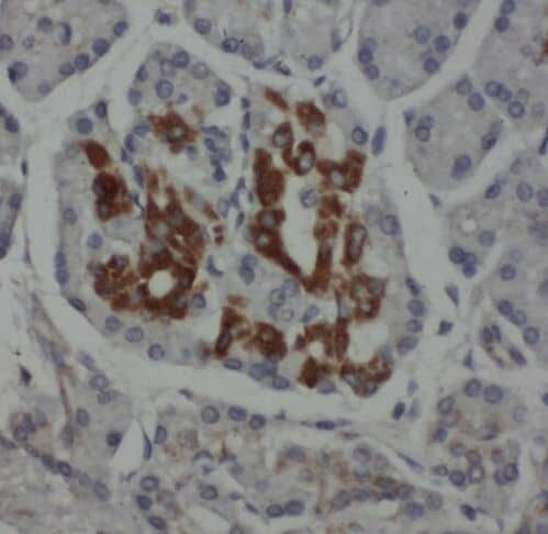 Immunohistochemistry: RPL38 Antibody - BSA Free [NBP3-46673] - Immunohistochemistry of paraffin-embedded human pancreas cancer using (RPL38 antibody) at dilution of 1:50
