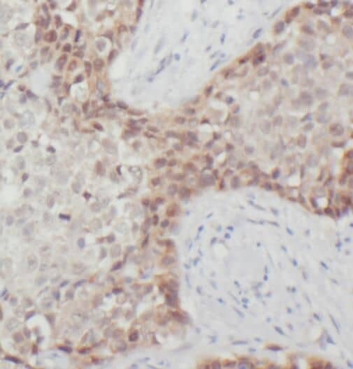 Immunohistochemistry RPL37A Antibody - BSA Free