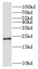 Western Blot: Ribosomal Protein L24 Antibody - BSA Free [NBP3-46681] - Jurkat cells were subjected to SDS PAGE followed by western blot with (Ribosomal Protein L24 antibody) at dilution of 1:500
