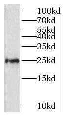 Western Blot: RPL10 Antibody - BSA Free [NBP3-46687] - Mouse thymus tissue were subjected to SDS PAGE followed by western blot with (RPL10 antibody) at dilution of 1:500