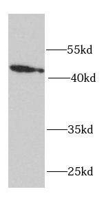 Western Blot: RPH3AL Antibody - BSA Free [NBP3-46688] - HeLa cells were subjected to SDS PAGE followed by western blot with (RPH3AL antibody) at dilution of 1:1000