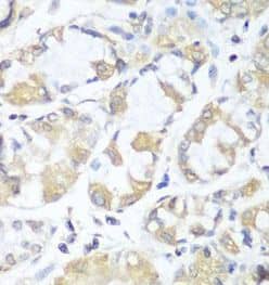 Immunohistochemistry: RPH3AL Antibody - BSA Free [NBP3-46688] - Immunohistochemistry of paraffin-embedded human stomach using (RPH3AL antibody) at dilution of 1:100