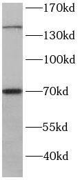 Western Blot: RPGRIP1 Antibody - BSA Free [NBP3-46690] - HEK-293 cells were subjected to SDS PAGE followed by western blot with (RPGRIP1 antibody) at dilution of 1:400