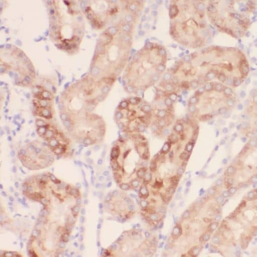 Immunohistochemistry: RPGR Antibody - BSA Free [NBP3-46691] - Immunohistochemistry of paraffin-embedded human kidney tissue slide using (RPGR Antibody) at dilution of 1:50