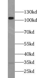 Western Blot: RPGR Antibody - BSA Free [NBP3-46691] - Mouse eye tissue were subjected to SDS PAGE followed by western blot with (RPGR antibody) at dilution of 1:500