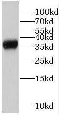 Western Blot: RPAIN Antibody - BSA Free [NBP3-46695] - Mouse ovary tissue were subjected to SDS PAGE followed by western blot with (RPAIN antibody) at dilution of 1:300
