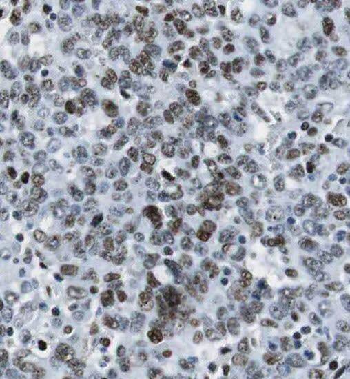 Immunohistochemistry RPAIN Antibody - BSA Free