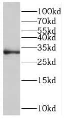 Western Blot: ROGDI Antibody - BSA Free [NBP3-46697] - Human brain tissue were subjected to SDS PAGE followed by western blot with (ROGDI antibody) at dilution of 1:500