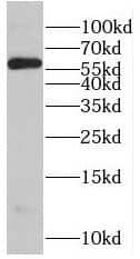 Western Blot: RNPS1 Antibody - BSA Free [NBP3-46698] - HEK-293 cells were subjected to SDS PAGE followed by western blot with (RNPS1 antibody) at dilution of 1:1000