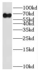 Western Blot RNPC3 Antibody - BSA Free