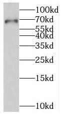 Western Blot: RNGTT Antibody - BSA Free [NBP3-46701] - Human kidney tissue were subjected to SDS PAGE followed by western blot with (RNGTT antibody) at dilution of 1:800