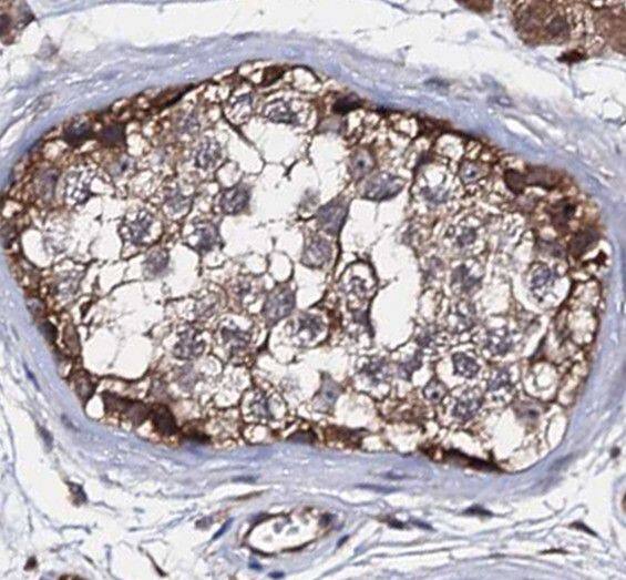 Immunohistochemistry: RNF133 Antibody - BSA Free [NBP3-46712] - Immunohistochemistry of paraffin-embedded human testis using (RNF133 antibody) at dilution of 1:50