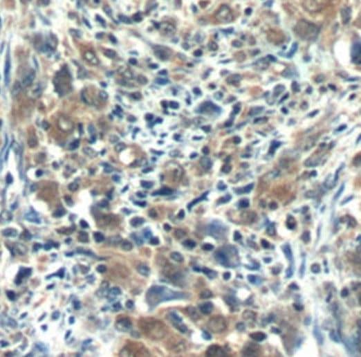 Immunohistochemistry RNF125 Antibody - BSA Free
