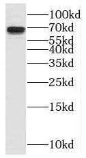 Western Blot: ZNF179 Antibody - BSA Free [NBP3-46714] - Mouse kidney tissue were subjected to SDS PAGE followed by western blot with ( ZNF179 Antibody) at dilution of 1:600