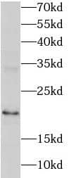 Western Blot: RNASEH2C Antibody - BSA Free [NBP3-46717] - Human testis tissue were subjected to SDS PAGE followed by western blot with (RNASEH2C antibody) at dilution of 1:600