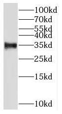 Western Blot: RNASEH2B Antibody - BSA Free [NBP3-46718] - Mouse thymus tissue were subjected to SDS PAGE followed by western blot with (RNASEH2B antibody) at dilution of 1:500