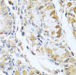 Immunohistochemistry: RNASE13 Antibody - BSA Free [NBP3-46719] - Immunohistochemistry of paraffin-embedded human stomach tissue slide using ( RNASE13 Antibody) at dilution of 1:100