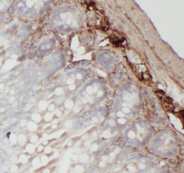 Immunohistochemistry: RMND5B Antibody - BSA Free [NBP3-46721] - Immunohistochemistry of paraffin-embedded human colon tissue slide using (RMND5B Antibody) at dilution of 1:50