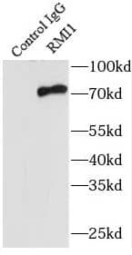 Immunoprecipitation: BLAP75 Antibody - BSA Free [NBP3-46722] - IP Result of anti-BLAP75 (IP:, 3ug; Detection: 1:1500) with HeLa cells lysate 3800ug.