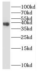 Western Blot CLVS2 Antibody - BSA Free