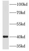 Western Blot: RIMS3 Antibody - BSA Free [NBP3-46727] - HL-60 cells were subjected to SDS PAGE followed by western blot with (RIMS3 antibody) at dilution of 1:500