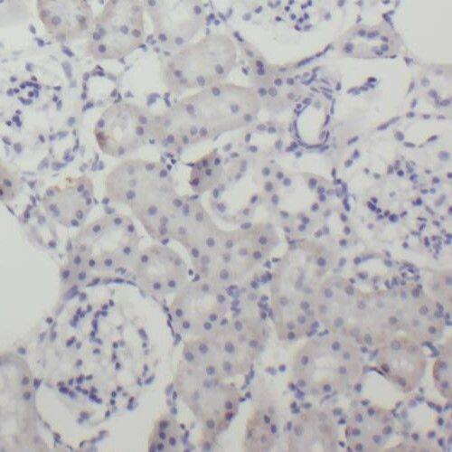Immunohistochemistry: RIMS Binding Protein 2 Antibody - BSA Free [NBP3-46729] - Immunohistochemistry of paraffin-embedded human kidney tissue slide using (RIMS Binding Protein 2 Antibody) at dilution of 1:50