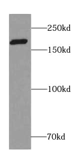 Western Blot: RIMS1 Antibody - BSA Free [NBP3-46731] - Mouse brain tissue were subjected to SDS PAGE followed by western blot with (RIMS1 antibody) at dilution of 1:2000