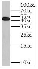 Western Blot: RILP Antibody - BSA Free [NBP3-46733] - HEK-293 cells were subjected to SDS PAGE followed by western blot with ( RILP Antibody) at dilution of 1:300
