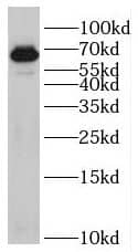 Western Blot: RIC8B Antibody - BSA Free [NBP3-46734] - Human brain tissue were subjected to SDS PAGE followed by western blot with (RIC8B antibody) at dilution of 1:1000