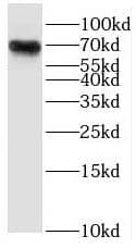 Western Blot: RHPN1 Antibody - BSA Free [NBP3-46736] - Human brain tissue were subjected to SDS PAGE followed by western blot with (RHPN1 antibody) at dilution of 1:400