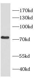 Immunohistochemistry: RHOT2 Antibody - BSA Free [NBP3-46737] - Immunohistochemistry of paraffin-embedded human heart using (RHOT2 antibody) at dilution of 1:50