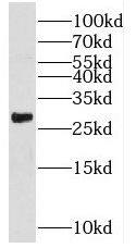 Western Blot: RHOT2 Antibody - BSA Free [NBP3-46737] - 293T cells were subjected to SDS PAGE followed by western blot with (RHOT2 antibody) at dilution of 1:1000